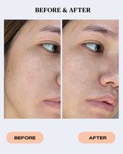 Load image into Gallery viewer, Facial Redness & Flaking Relief Cream | SEBO CONTROL