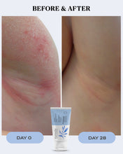 Load image into Gallery viewer, Eczema & Itch Relief Cream | CALM