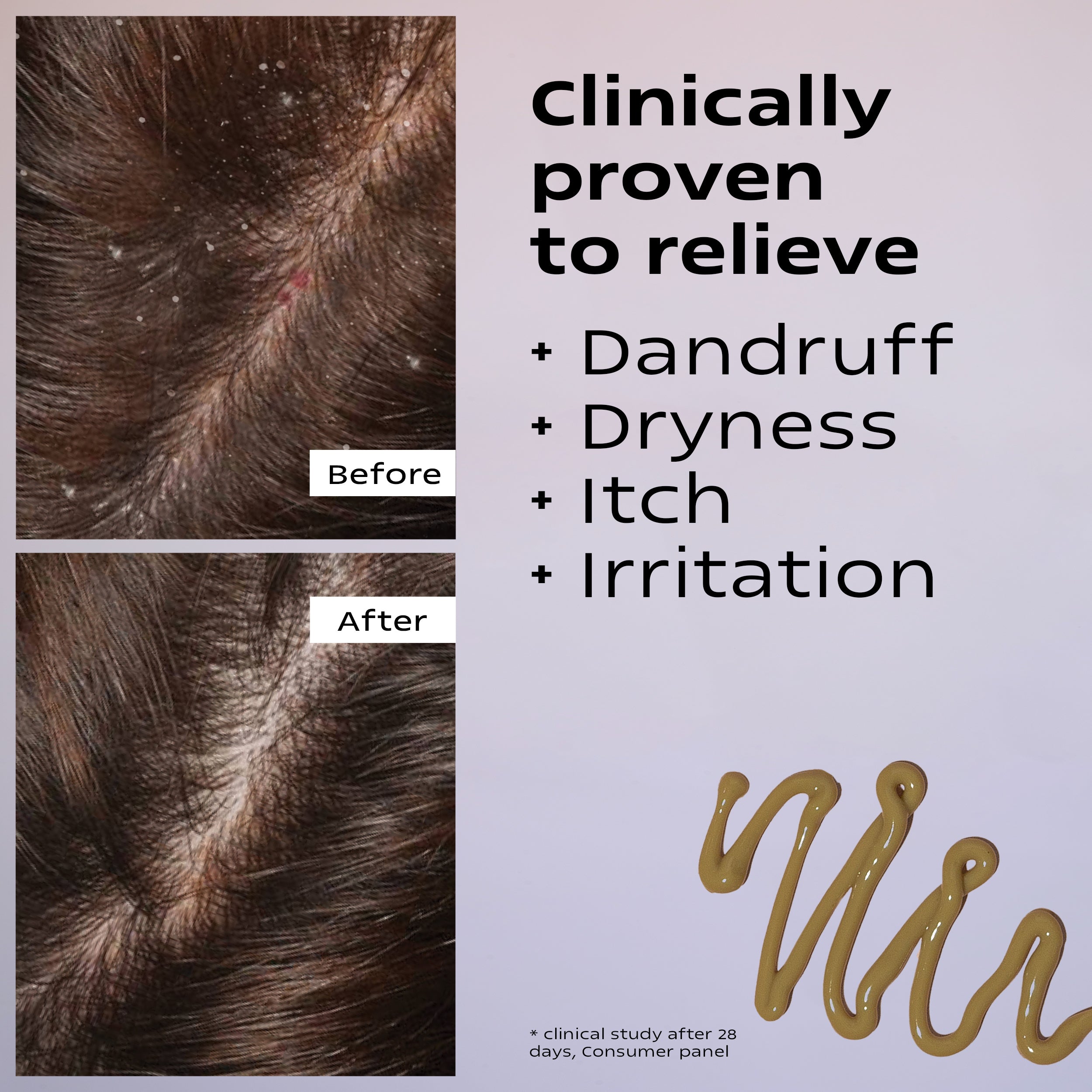 4 Scalp Lotion Travel Size 40ml