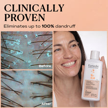 Load image into Gallery viewer, Ultimate Anti Dandruff Kit | SCALP CONTROL