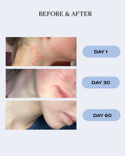 Load image into Gallery viewer, Hydrating Skin Recovery Gel | CALM