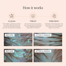 Load image into Gallery viewer, Anti Dandruff Shampoo - for test 2