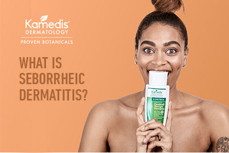 What is Seborrheic Dermatitis?
