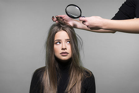 Five False Facts About Dandruff