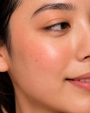 Load image into Gallery viewer, T-Zone Face Cleanser for Redness and Flaky Skin | SEBO CONTROL
