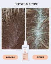 Load image into Gallery viewer, OTC Anti-Dandruff Shampoo | SCALP CONTROL
