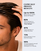 Load image into Gallery viewer, OTC Anti-Dandruff Shampoo | SCALP CONTROL
