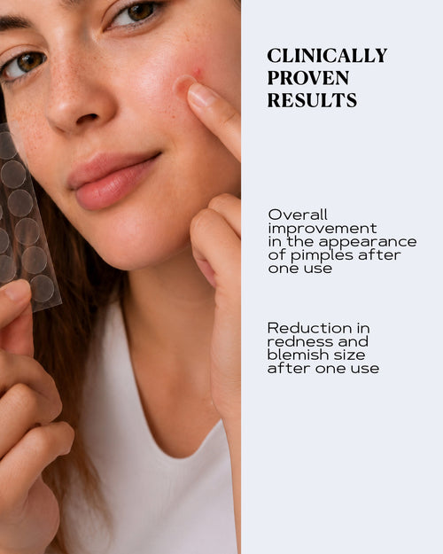 Advanced Transparent Pimple Patches for Fast Blemish Relief | CLEAR