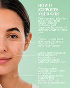 Transparent Pimple Patches for Fast Blemish Relief | CLEAR