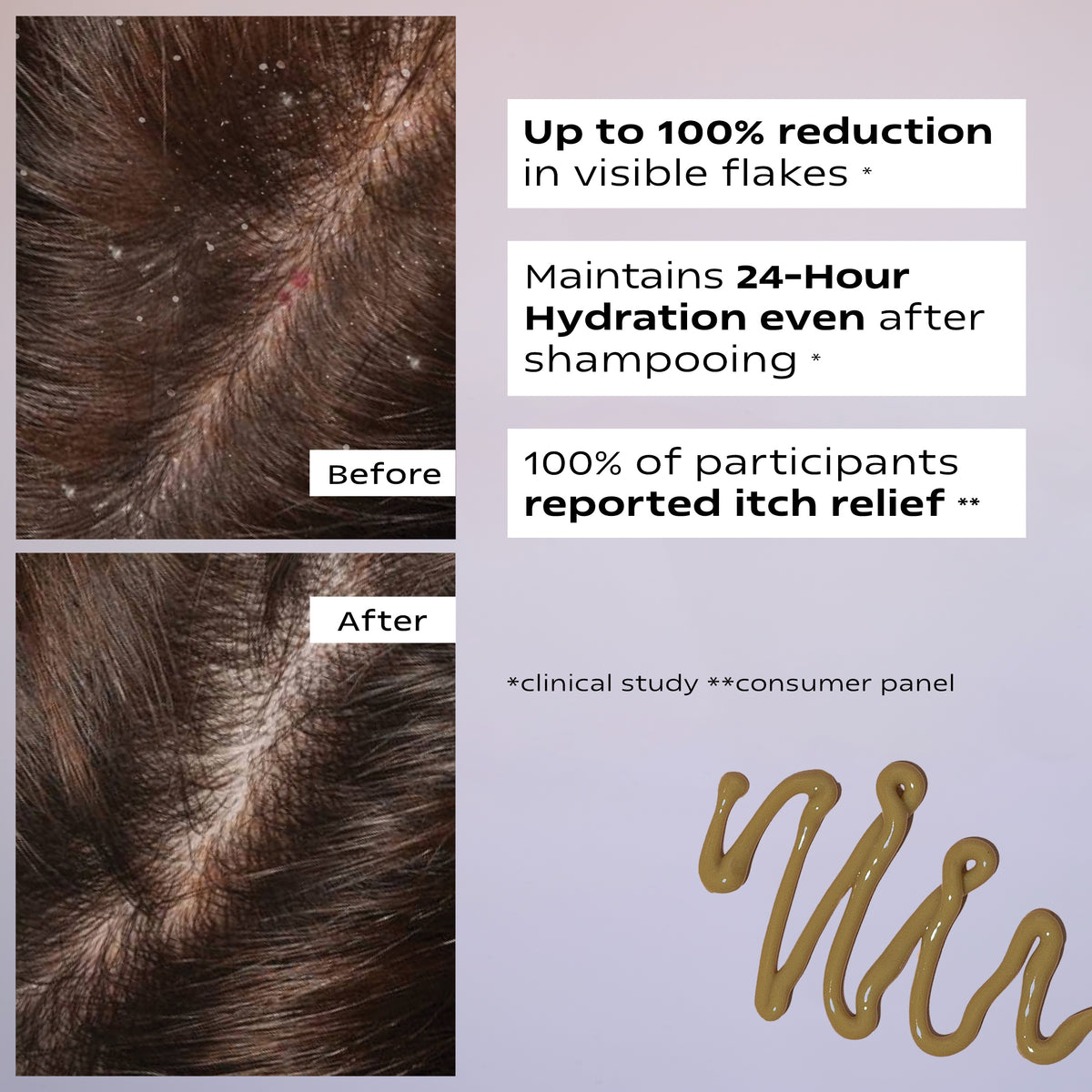 Ultimate Anti Dandruff Kit | SCALP CONTROL