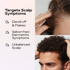 Ultimate Anti Dandruff Kit | SCALP CONTROL