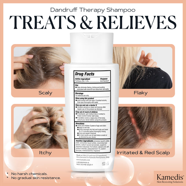 OTC Anti-Dandruff Shampoo